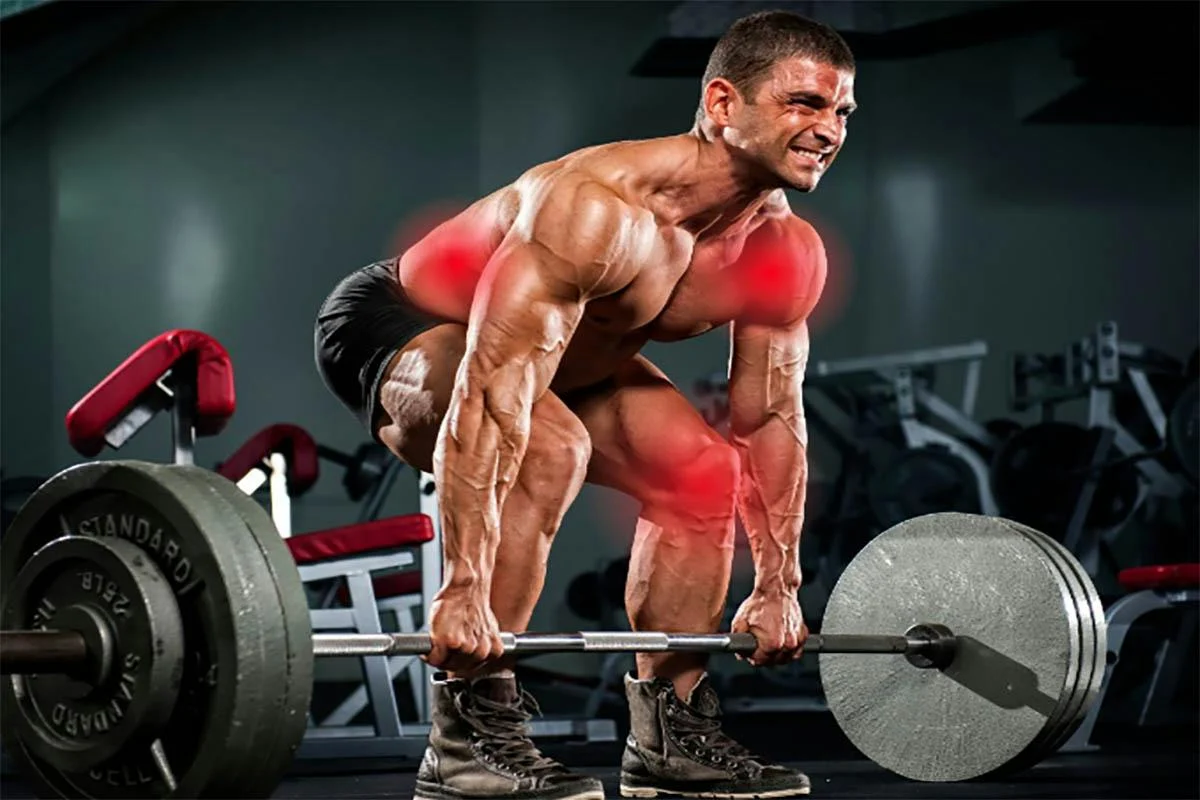 Can Lifting Heavy Weight Above Shoulders Cause ETD