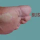 Blisterata: Advanced Skin Protection Solutions