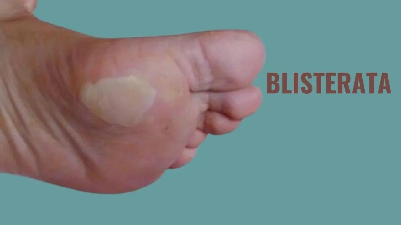 Blisterata: Advanced Skin Protection Solutions